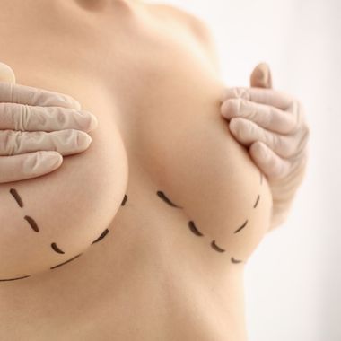 Breast Augmentation