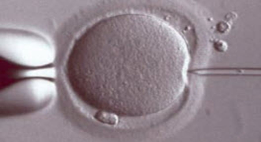 ICSI-Mikroenjeksiyon (Intra Cytoplasmic Sperm Injection)